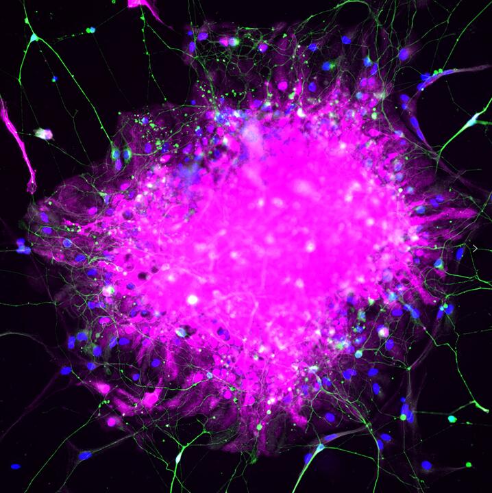 IF Staining of human astrocytes using 15146-1-AP