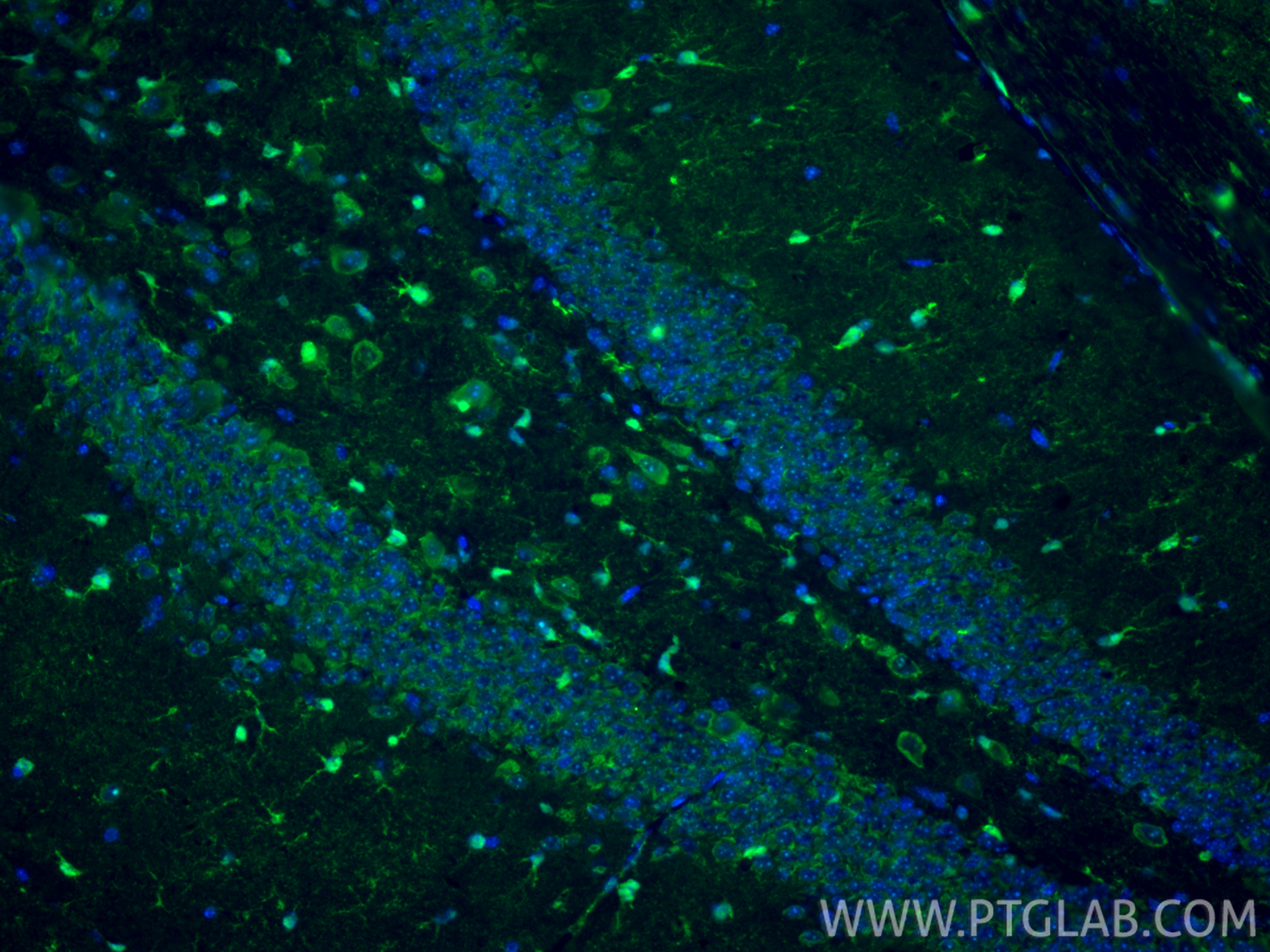 IF Staining of mouse brain using 15146-1-AP