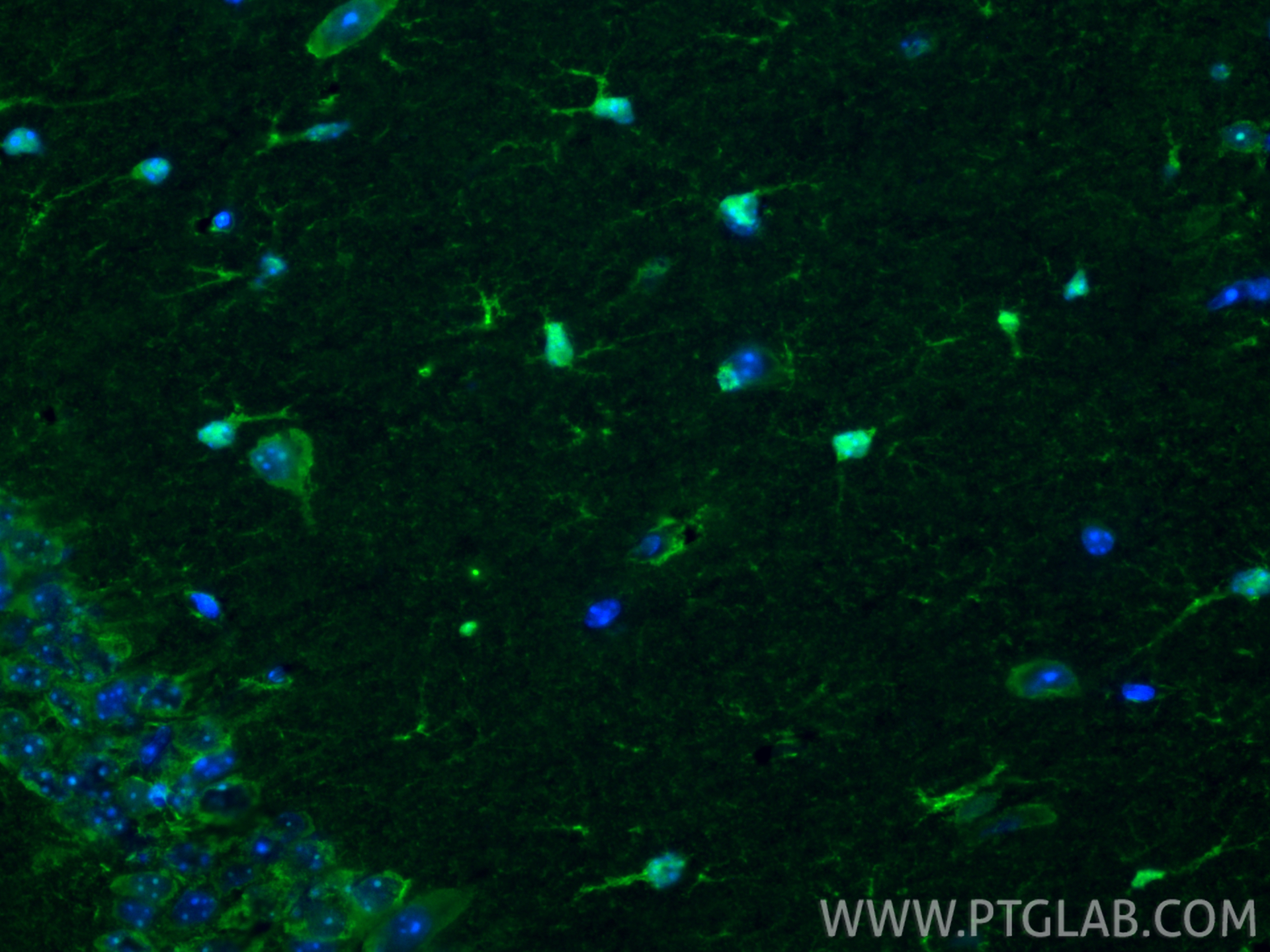 IF Staining of mouse brain using 15146-1-AP