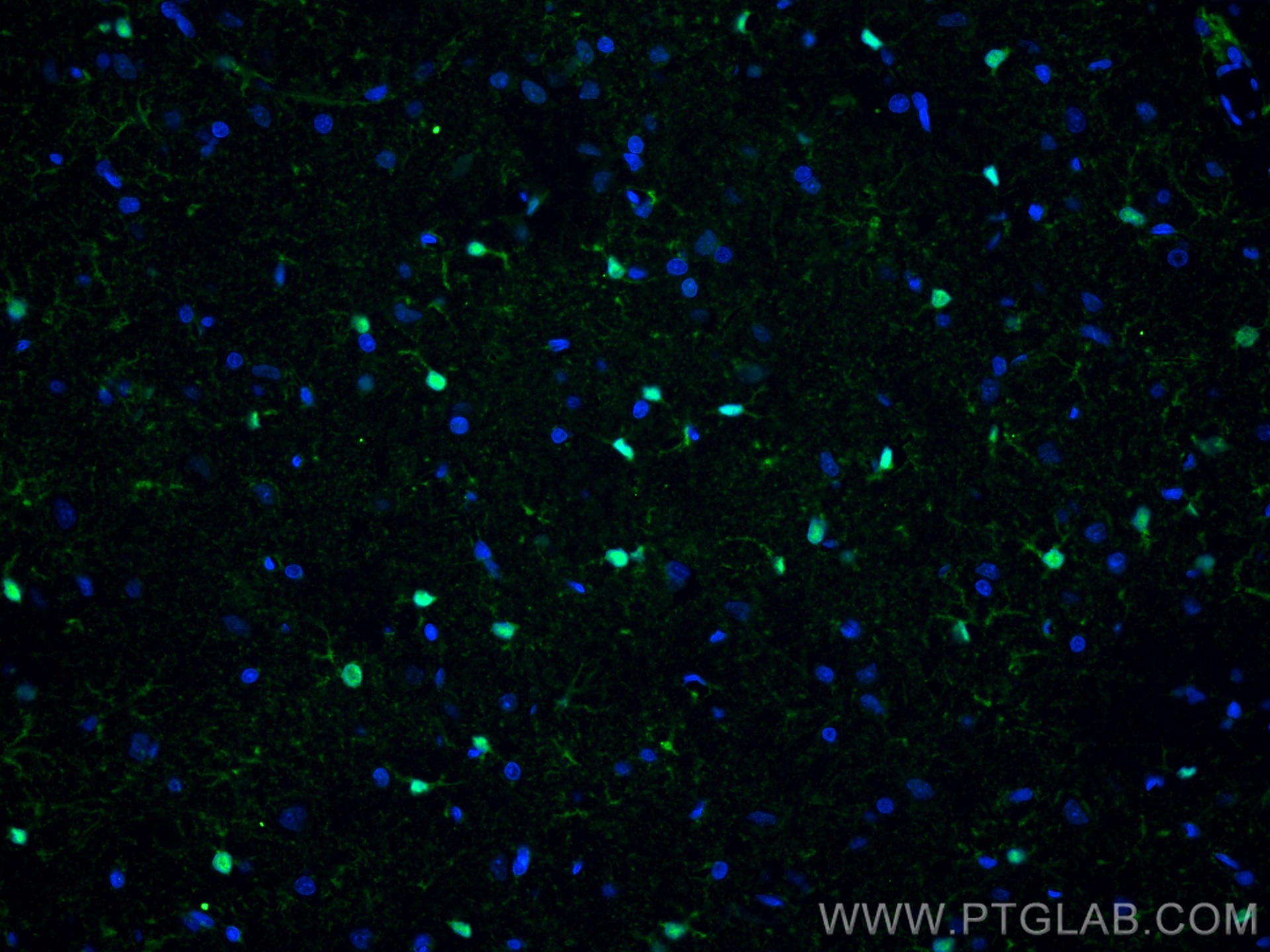 IF Staining of rat brain using 66616-1-Ig (same clone as 66616-1-PBS)