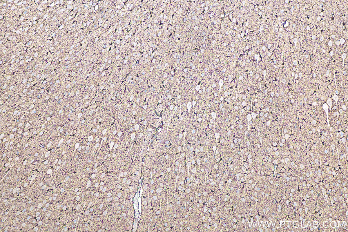IHC staining of rat brain using 66616-1-Ig