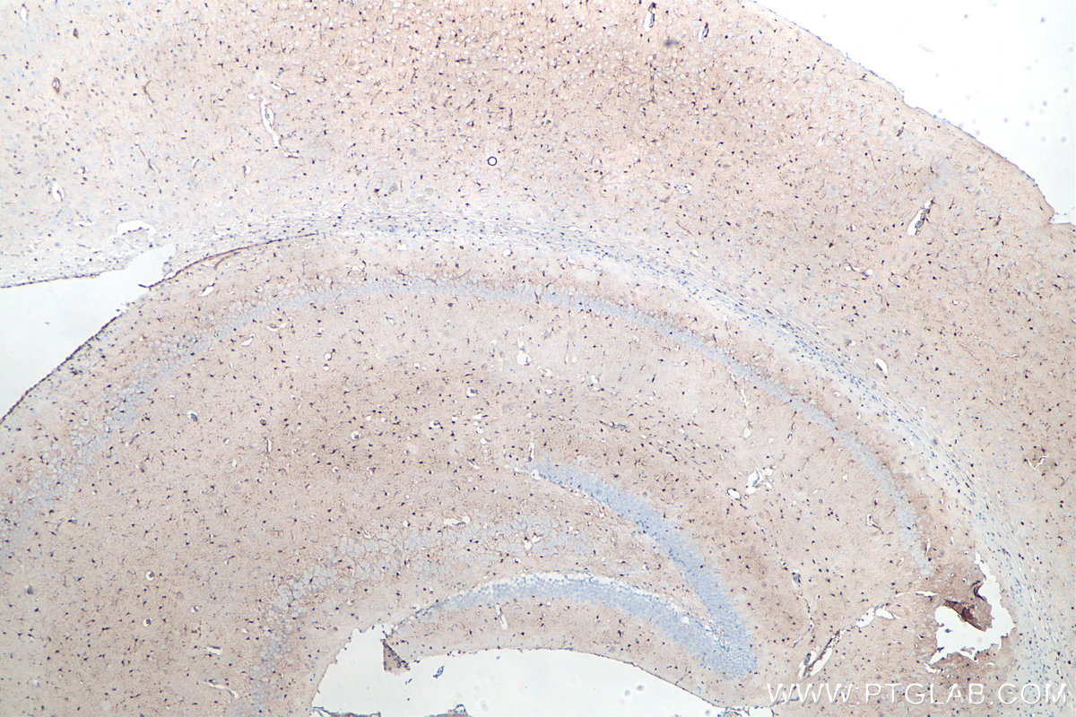 IHC staining of mouse brain using 66616-1-Ig