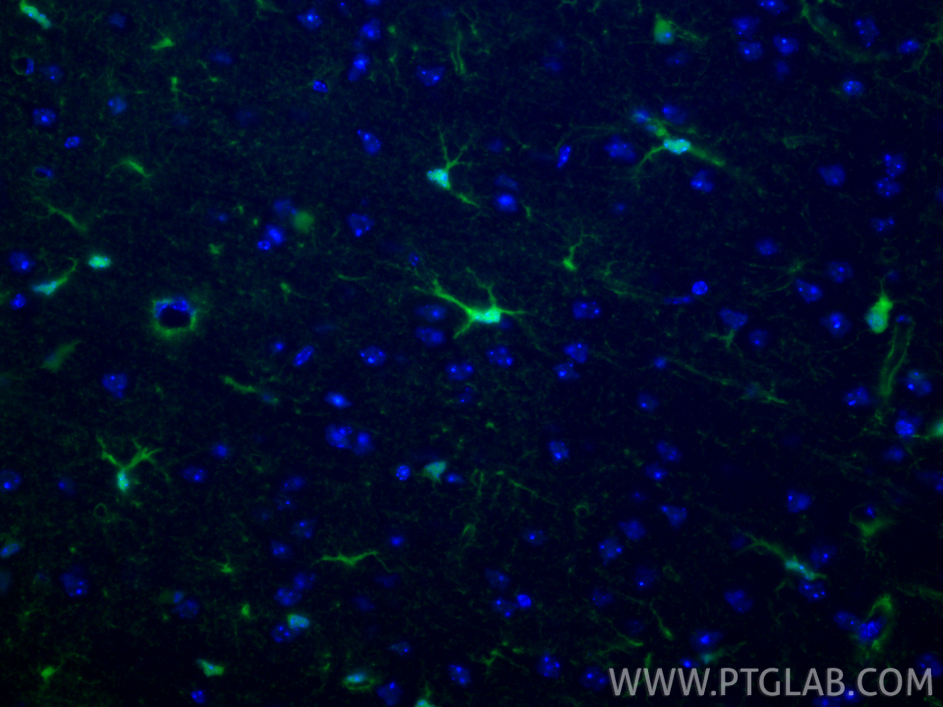 IF Staining of mouse brain using CL488-82271-8
