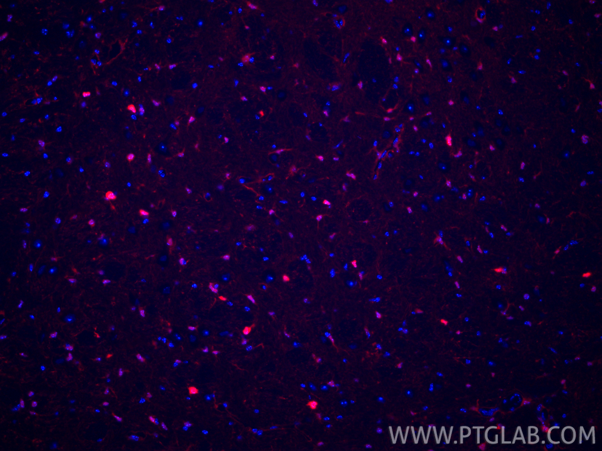 Immunofluorescent analysis of (4% PFA) fixed paraffin-embedded mouse brain tissue using CoraLite®594 S100B antibody (CL594-82271-8, Clone: 1E2 ) at dilution of 1:200. Heat mediated antigen retrieval with Tris-EDTA buffer (pH 9.0). IF Staining of mouse brain using CL594-82271-8