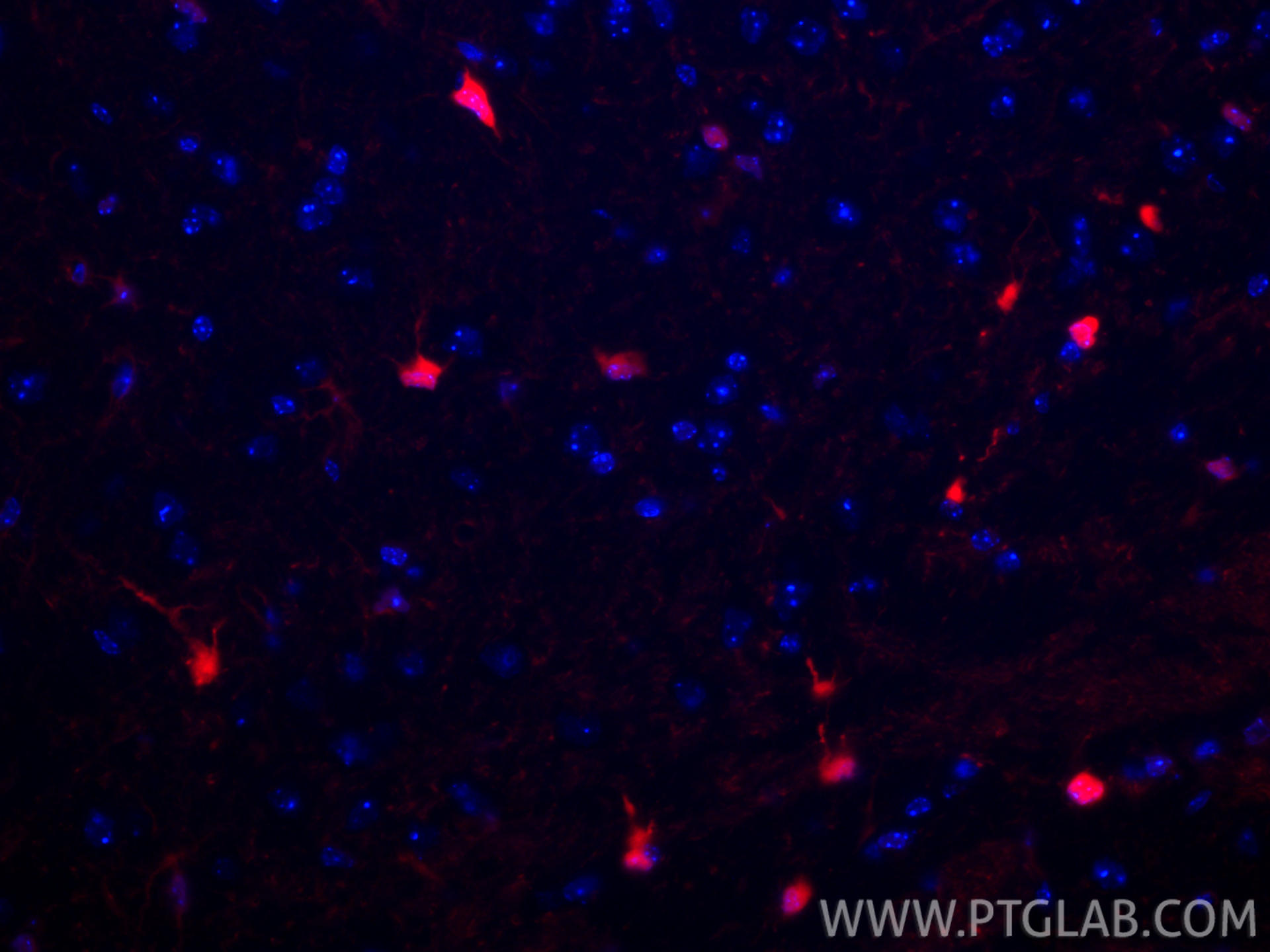 Immunofluorescent analysis of (4% PFA) fixed paraffin-embedded mouse brain tissue using CoraLite®594 S100B antibody (CL594-82271-8, Clone: 1E2 ) at dilution of 1:200. Heat mediated antigen retrieval with Tris-EDTA buffer (pH 9.0). IF Staining of mouse brain using CL594-82271-8