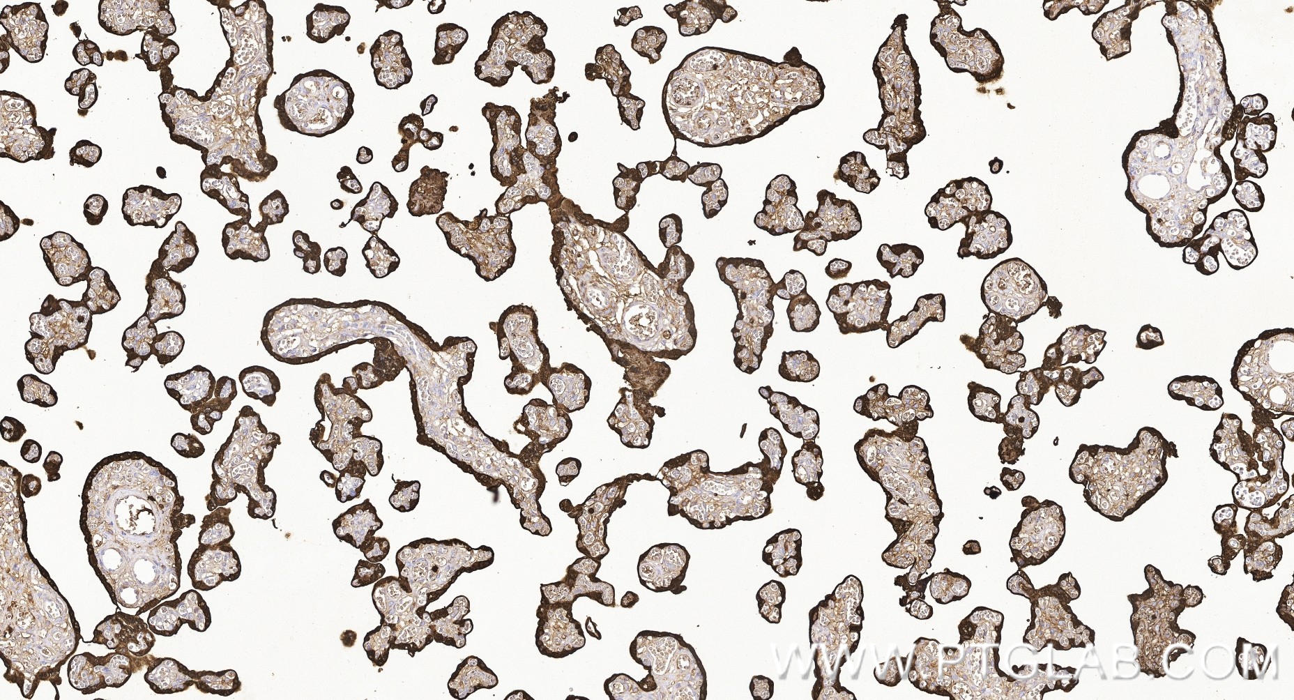IHC staining of human placenta using 88256-7-RR (same clone as 88256-7-PBS)