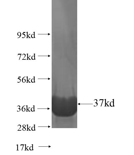 S100P fusion protein Ag2379 SDS-PAGE