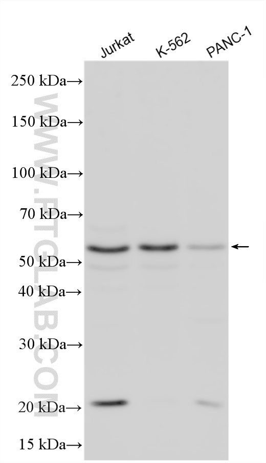 Various lysates were subjected to SDS PAGE followed by western blot with 33562-1-AP (S100PBP antibody) at dilution of 1:3000 incubated at room temperature for 1.5 hours. WB analysis using 33562-1-AP