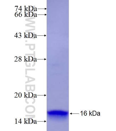S100Z fusion protein Ag27326 SDS-PAGE S100Z fusion protein Ag27326 SDS-PAGE