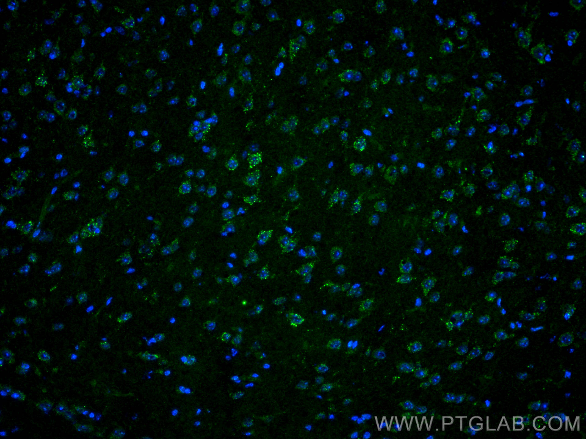IF Staining of mouse brain using 21180-1-AP