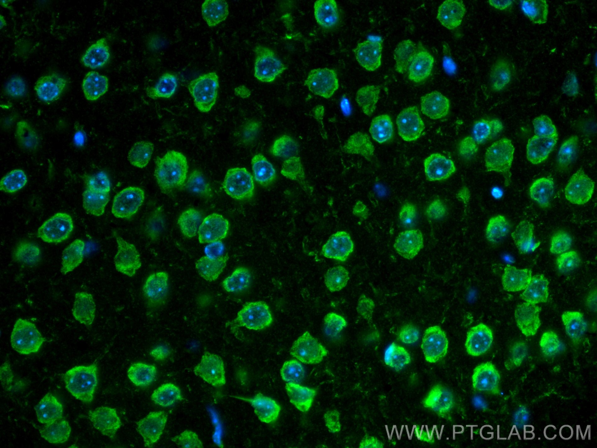 IF Staining of mouse brain using CL488-21180