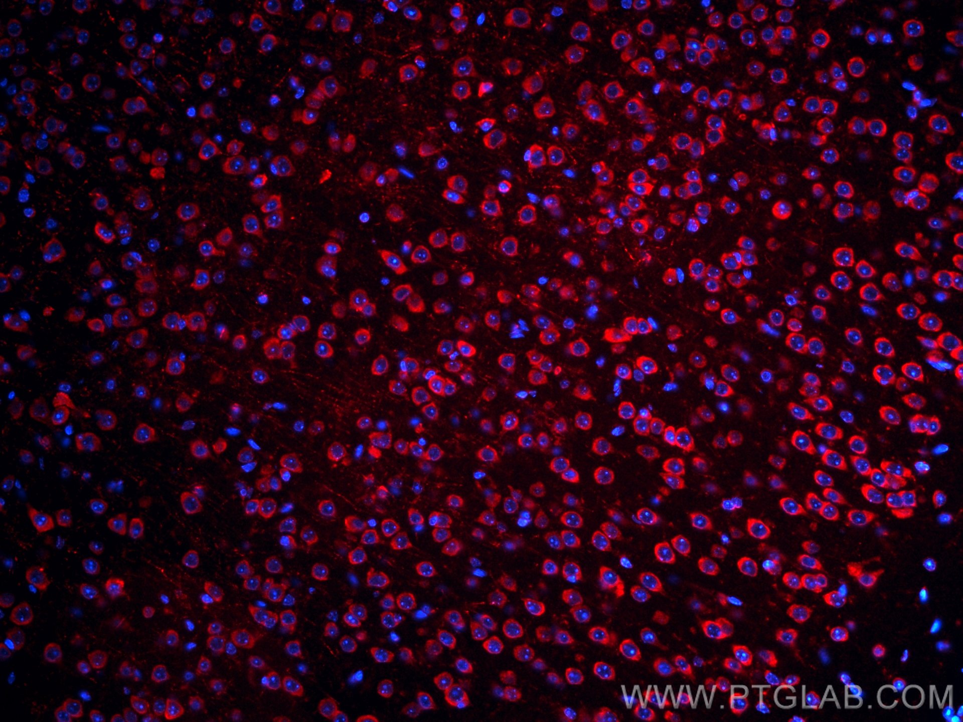 IF Staining of mouse brain using CL594-21180