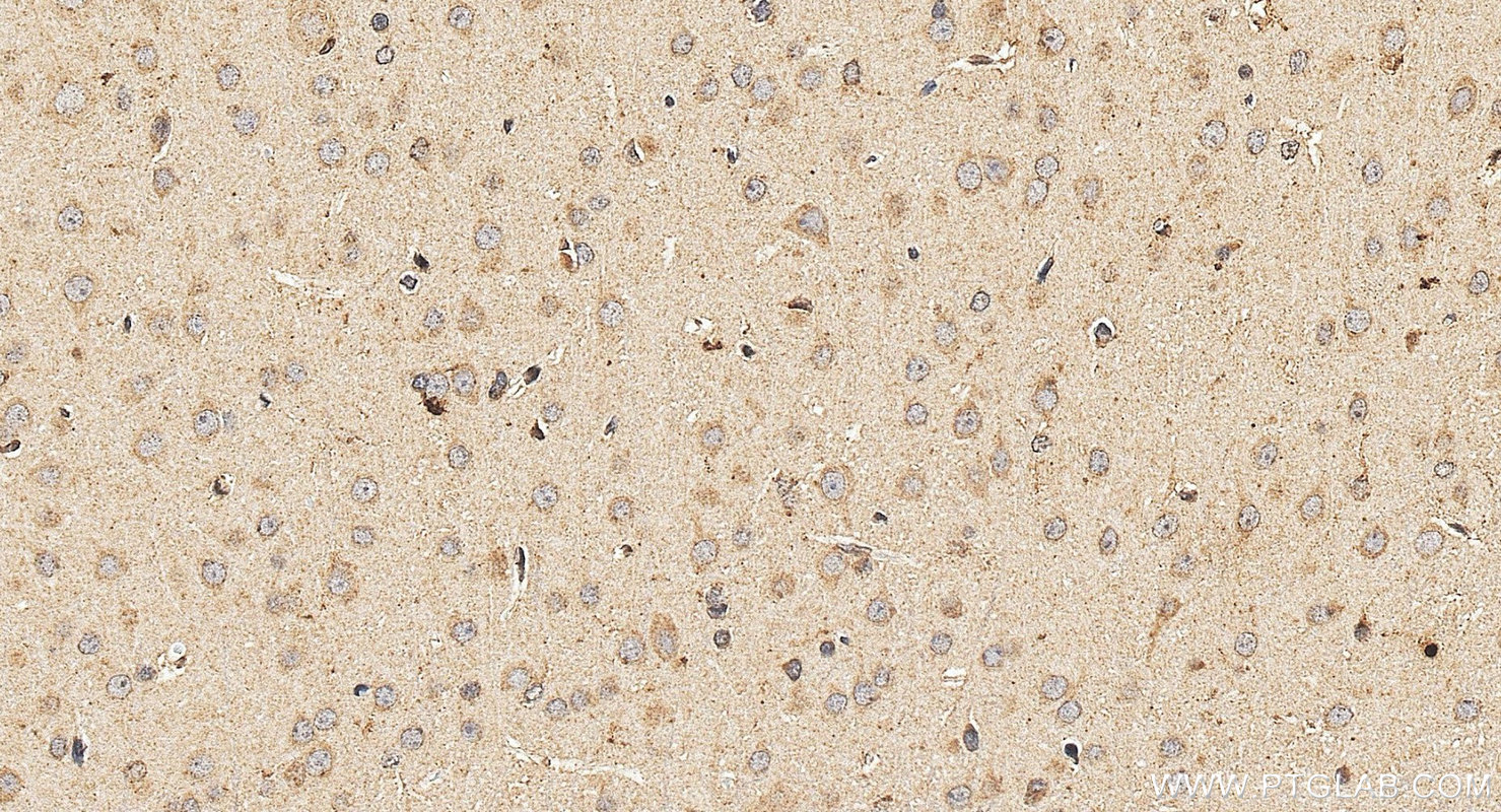 IHC staining of rat brain using 13874-1-AP IHC staining of rat brain using 13874-1-AP