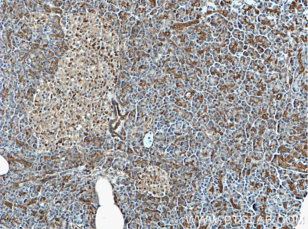 IHC staining of human pancreas using 55404-1-AP (same clone as 55404-1-PBS)