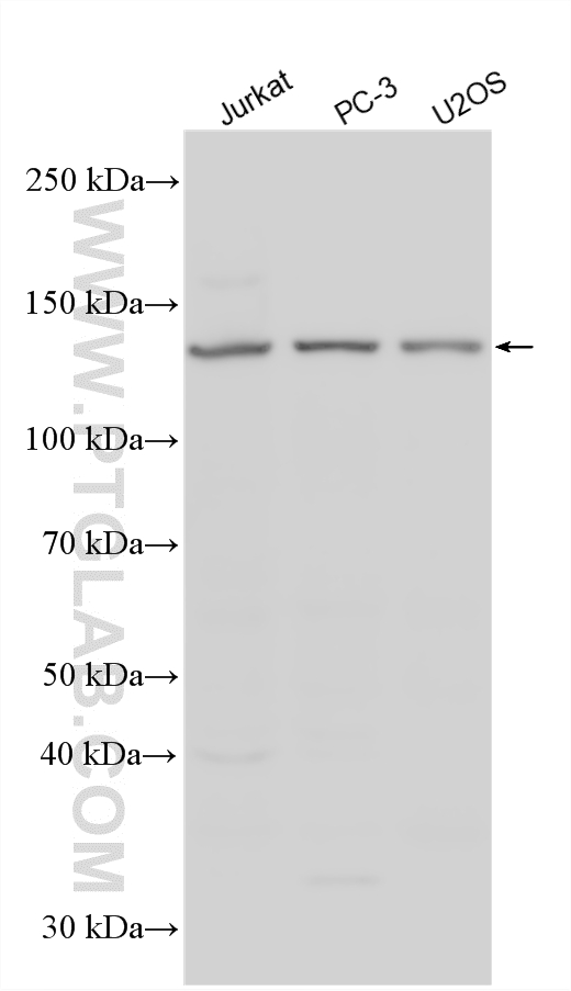 Various lysates were subjected to SDS PAGE followed by western blot with 55404-1-AP (PLIN4 antibody) at dilution of 1:1500 incubated at room temperature for 1.5 hours. WB analysis using 55404-1-AP