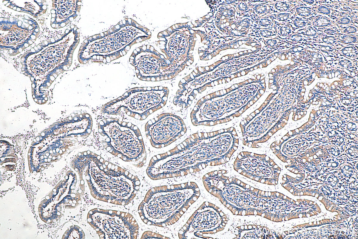 IHC staining of human small intestine using 16721-1-AP