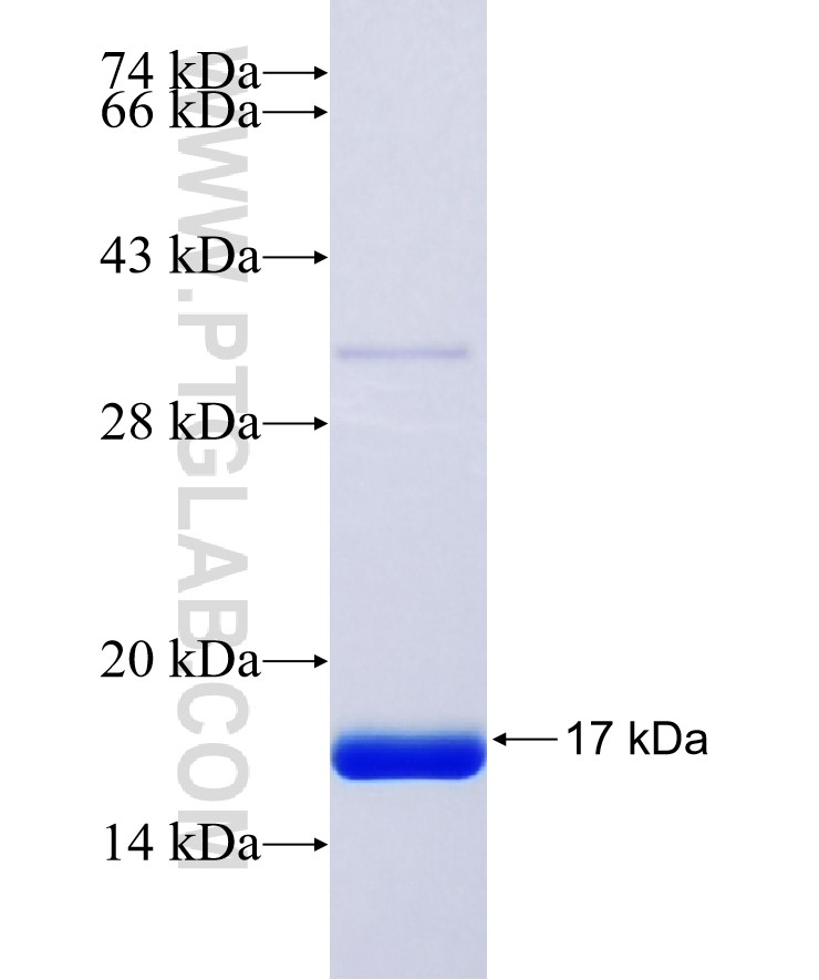 SAA1 fusion protein Ag23459 SDS-PAGE SAA1 fusion protein Ag23459 SDS-PAGE