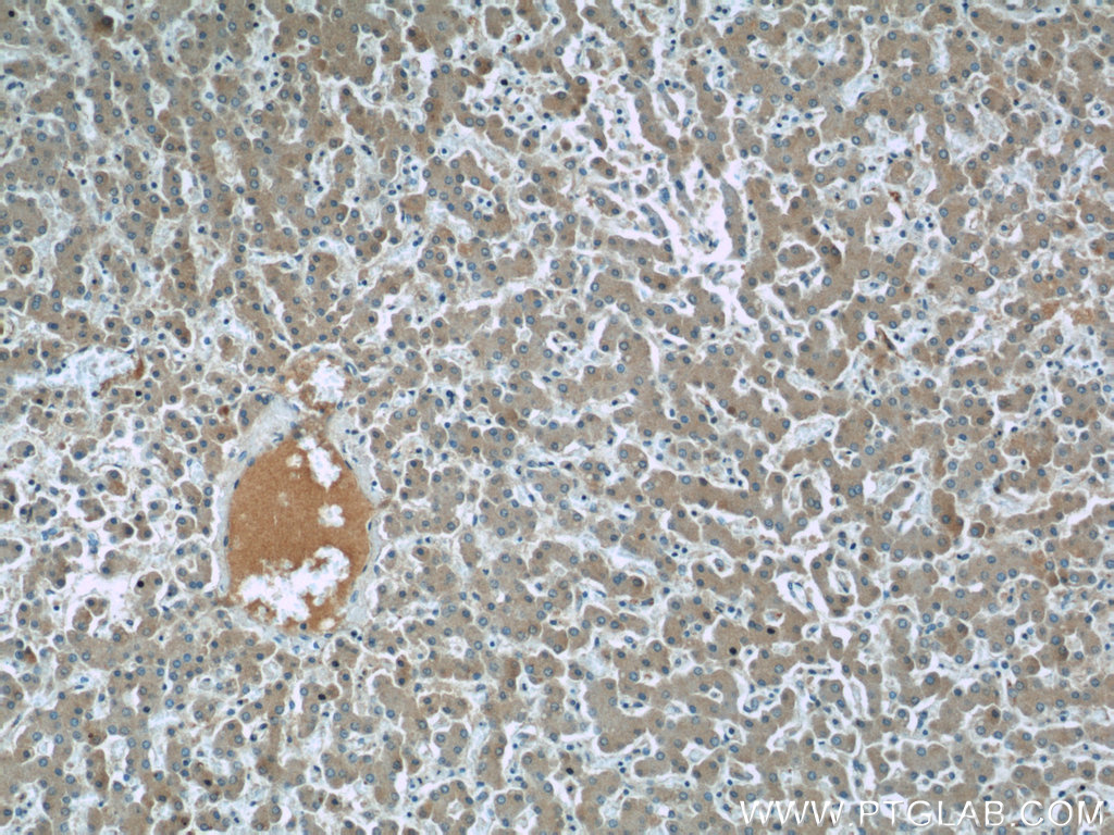 IHC staining of human liver using 20398-1-AP