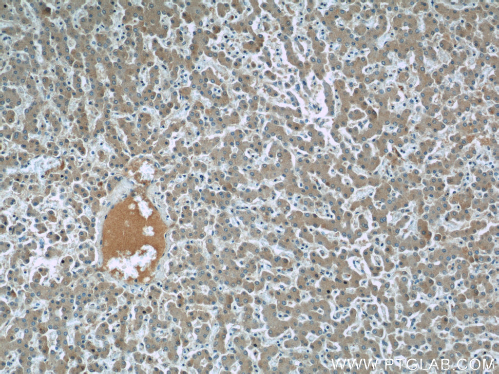 IHC staining of human liver using 20398-1-AP