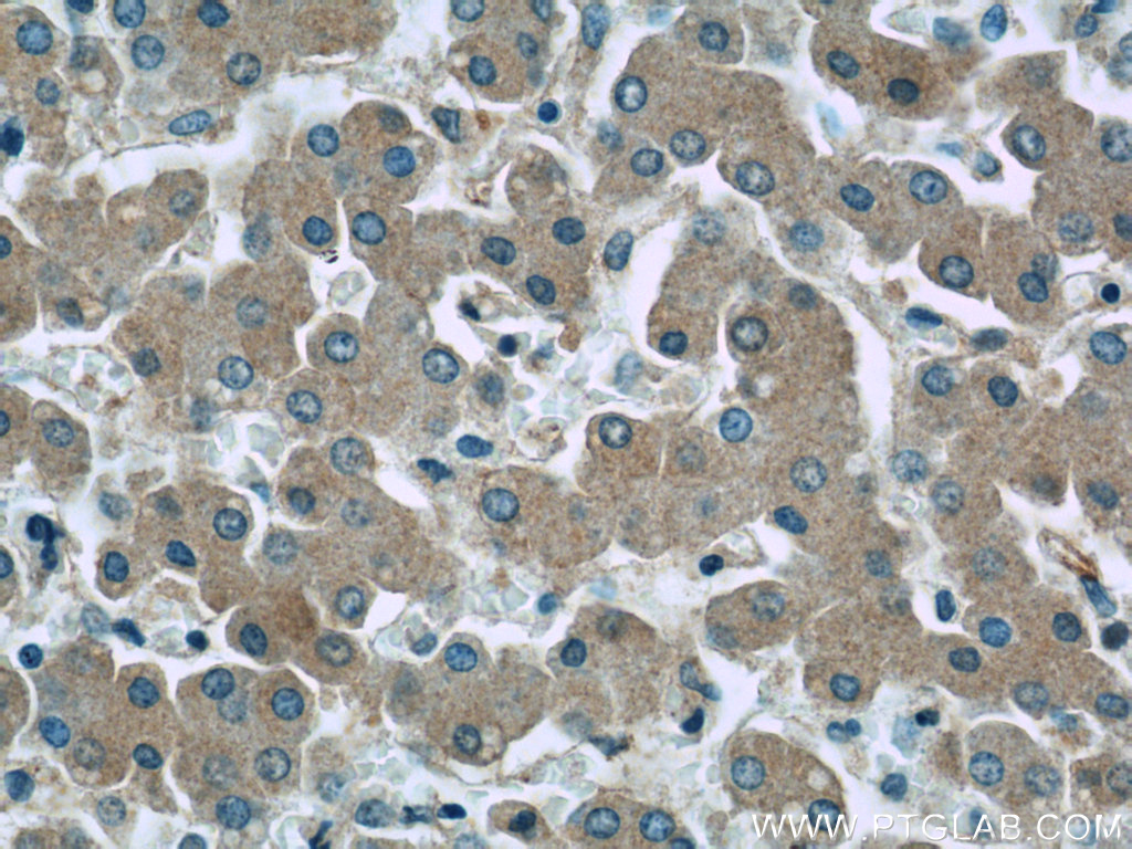 SAA4 Polyclonal antibody