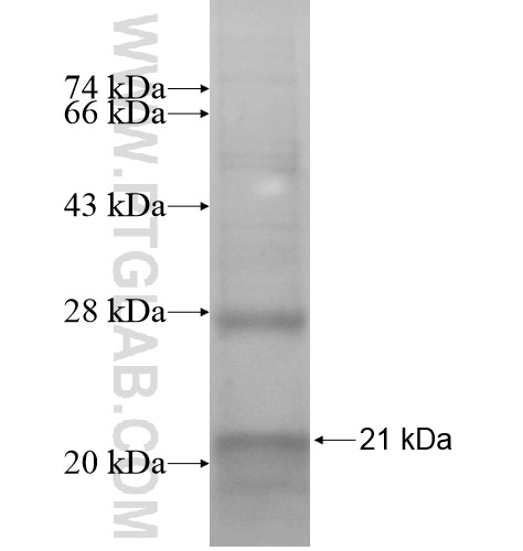 SAA4 fusion protein Ag15096 SDS-PAGE SAA4 fusion protein Ag15096 SDS-PAGE