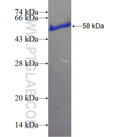 SAAL1 fusion protein Ag22186 SDS-PAGE