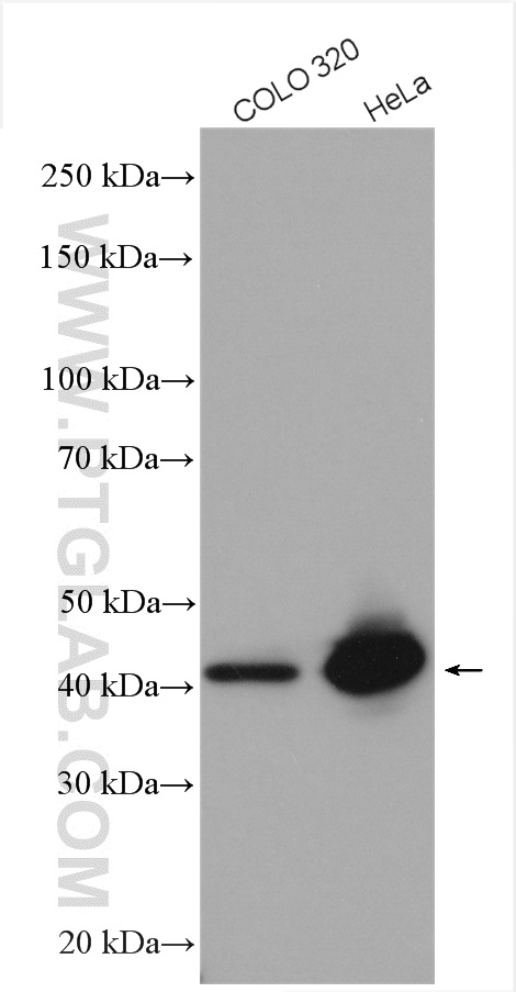 Various lysates were subjected to SDS PAGE followed by western blot with 25857-1-AP (SAC3D1 antibody) at dilution of 1:1000 incubated at room temperature for 1.5 hours. WB analysis using 25857-1-AP