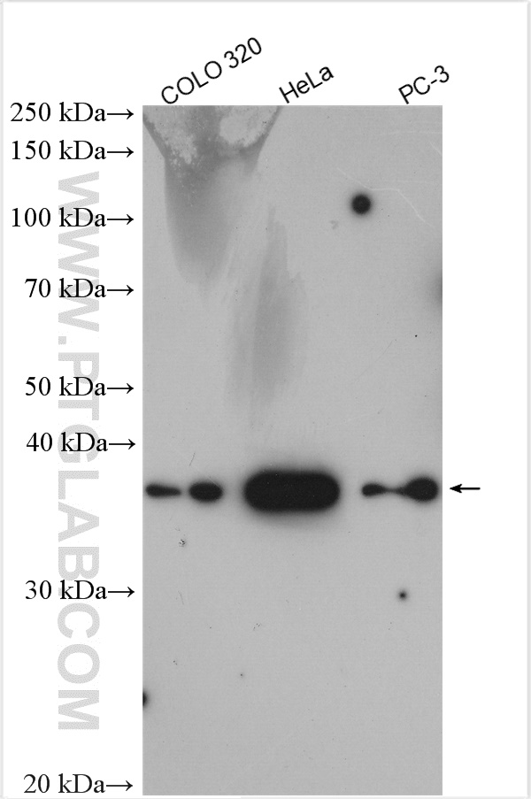 Various lysates were subjected to SDS PAGE followed by western blot with 25857-1-AP (SAC3D1 antibody) at dilution of 1:4000 incubated at room temperature for 1.5 hours. WB analysis using 25857-1-AP