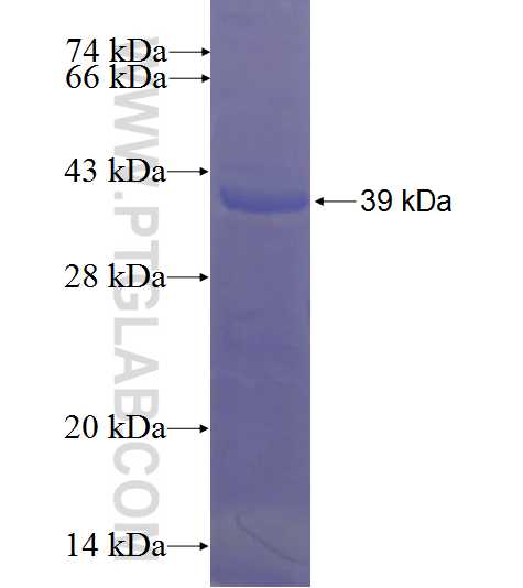 SAC3D1 fusion protein Ag23041 SDS-PAGE SAC3D1 fusion protein Ag23041 SDS-PAGE