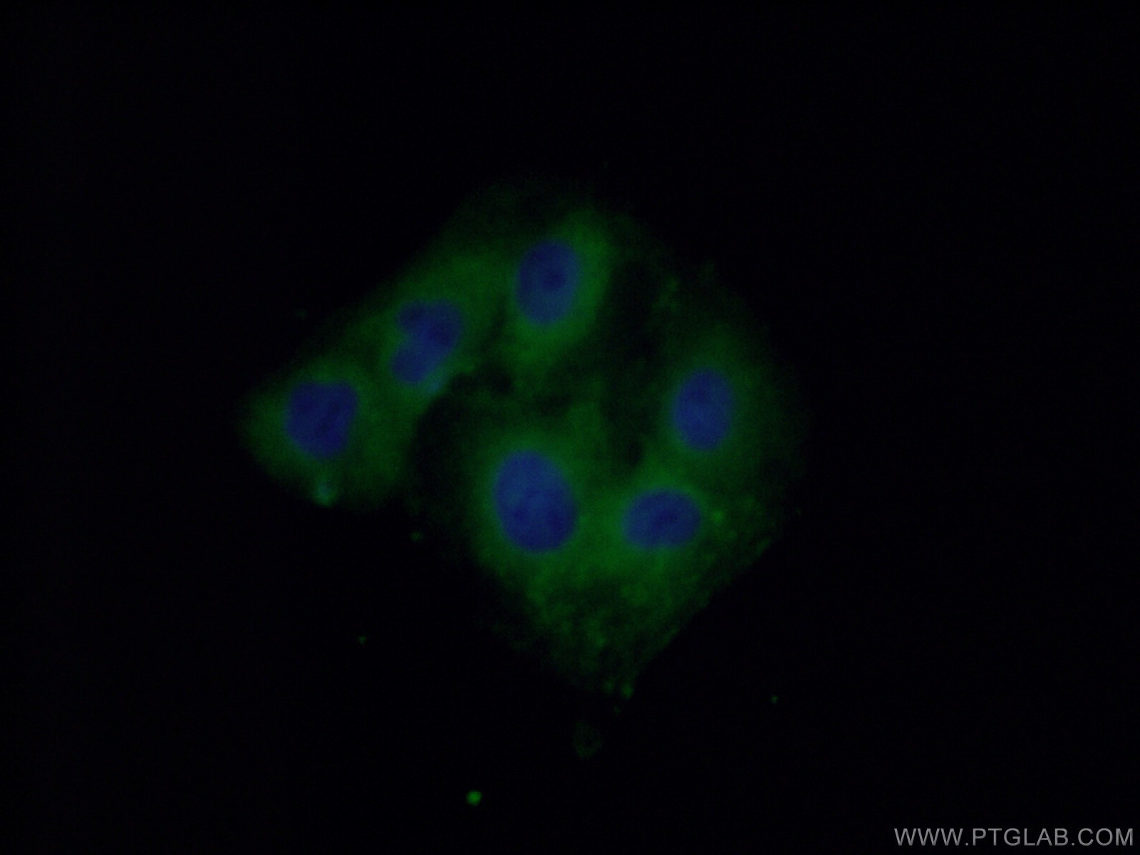 IF Staining of A549 using 13033-1-AP