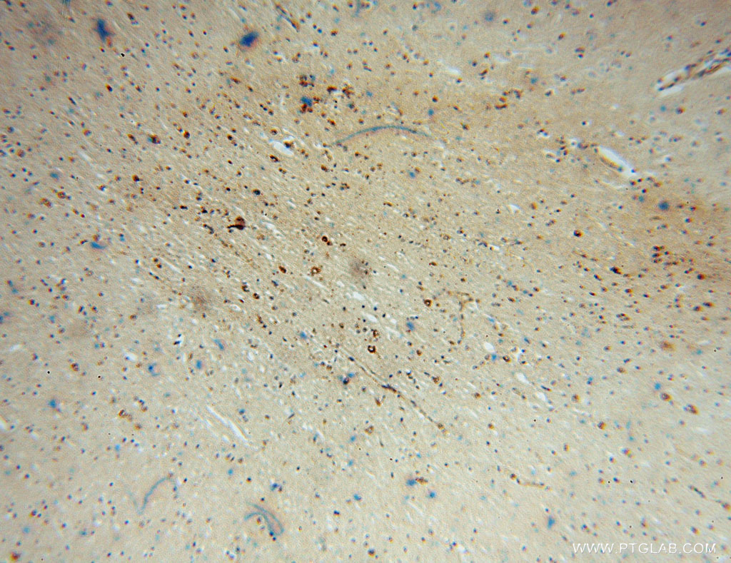 IHC staining of human brain using 13033-1-AP