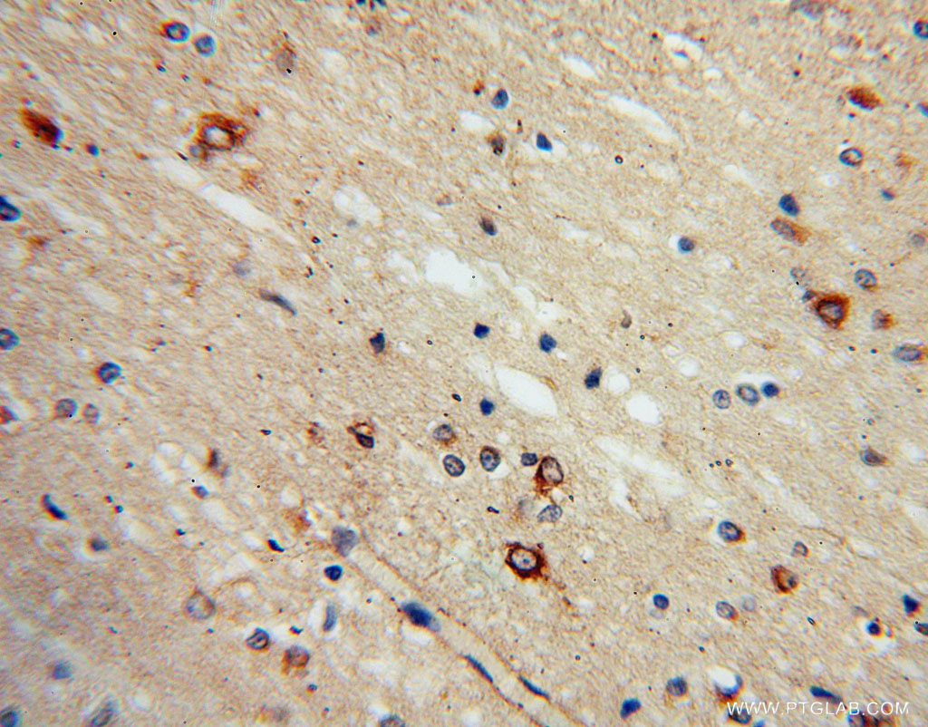 IHC staining of human brain using 13033-1-AP