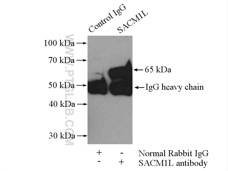 IP experiment of mouse kidney using 13033-1-AP