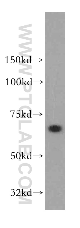 SACM1L Polyclonal antibody