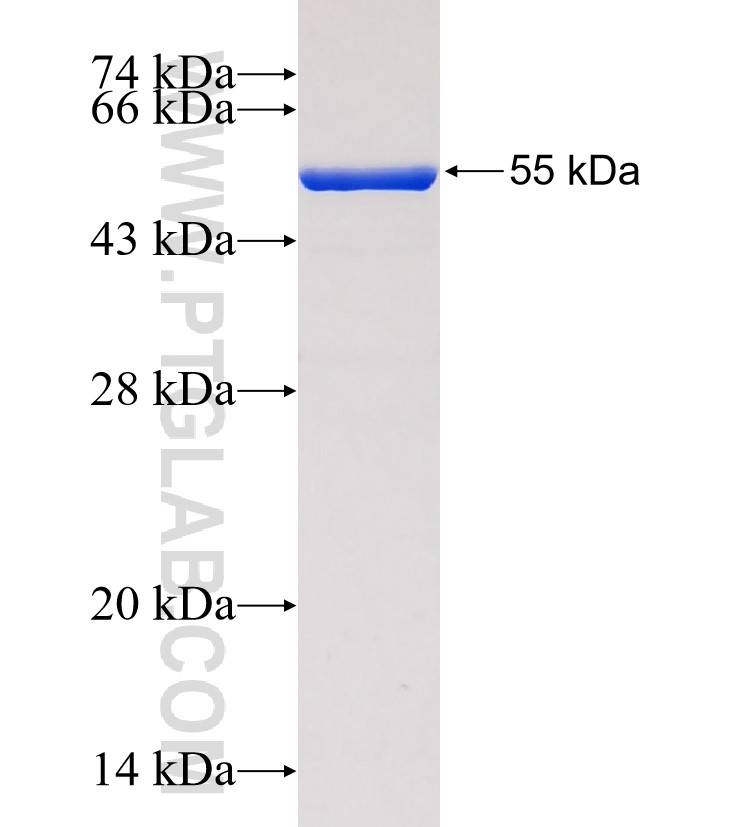 SAE1 fusion protein Ag0275 SDS-PAGE