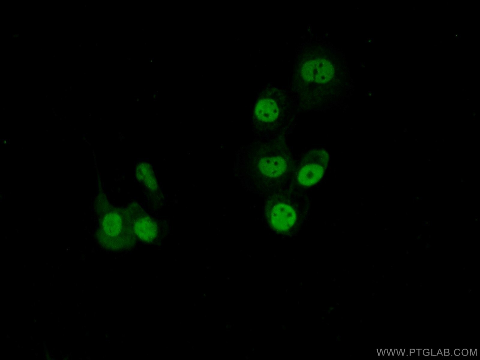 IF Staining of A431 using 21857-1-AP