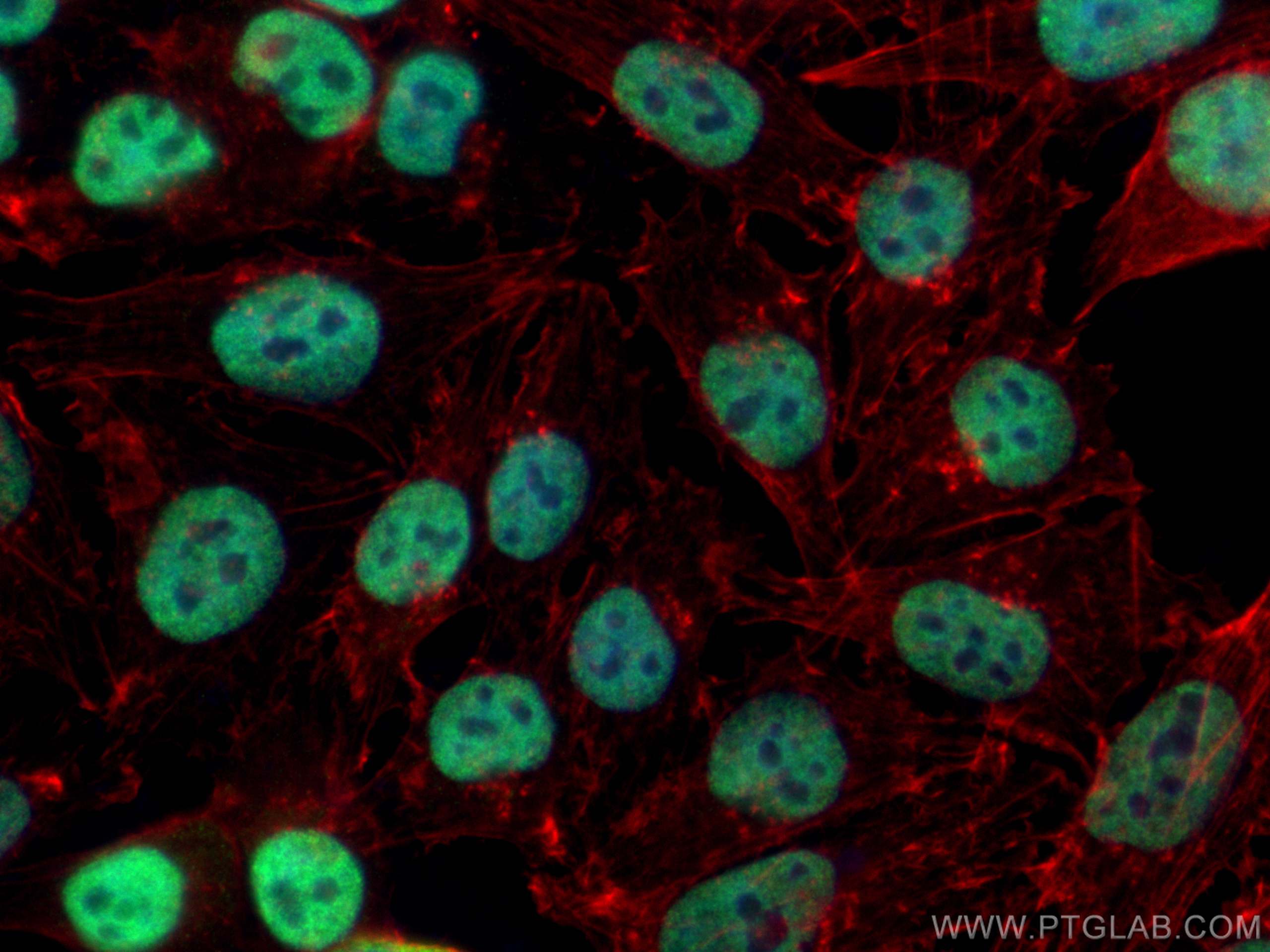 IF Staining of A375 using 30914-1-AP