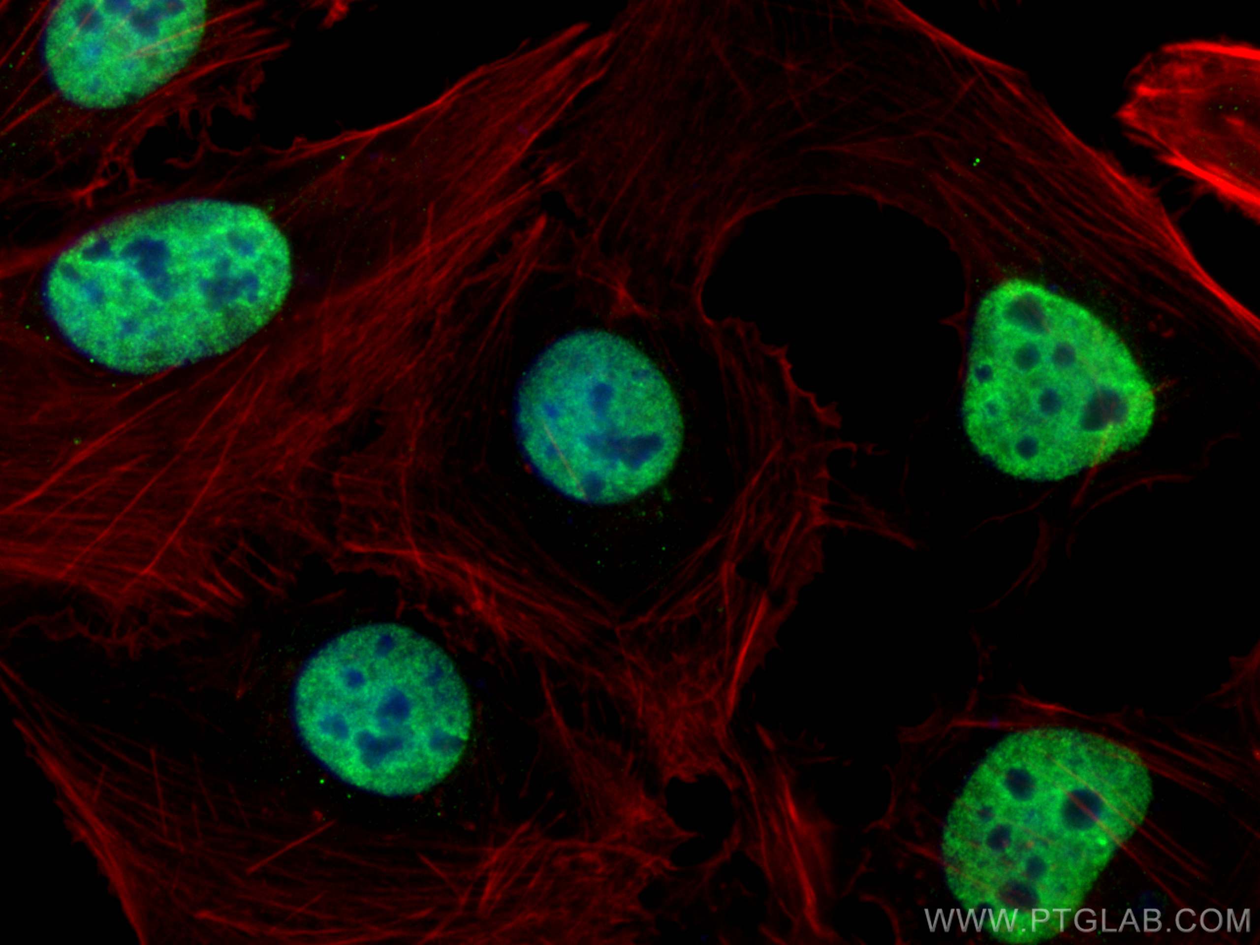 IF Staining of U2OS using 30914-1-AP