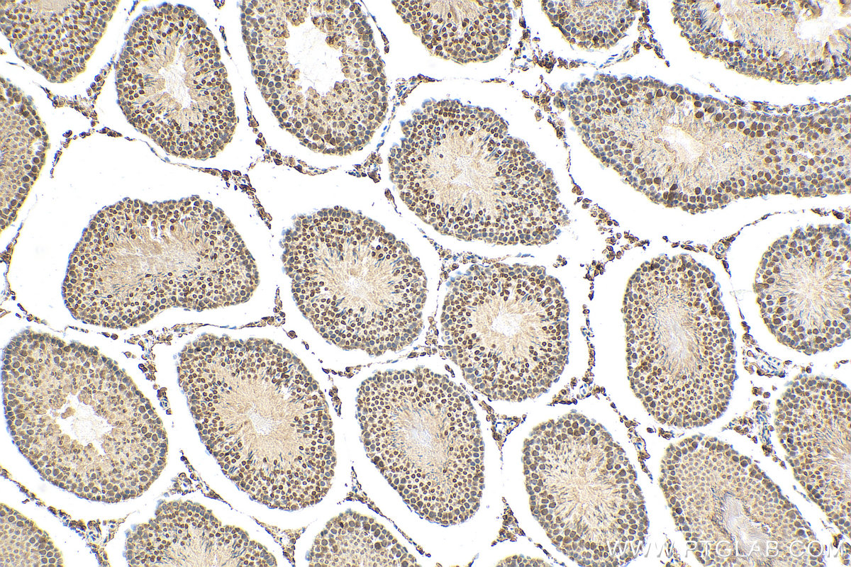 IHC staining of rat testis using 30914-1-AP