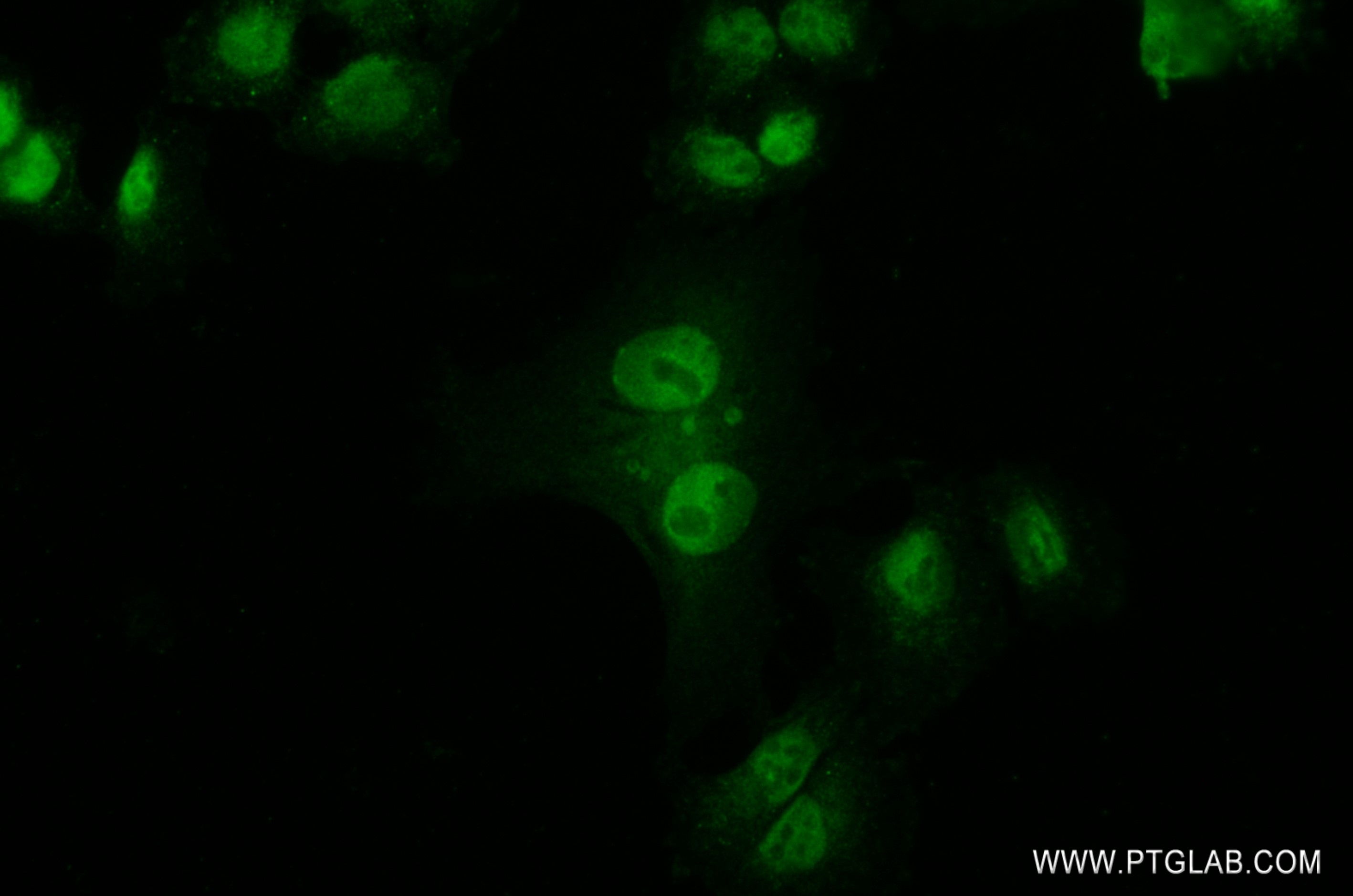 IF Staining of MDA-MB-453 using 82876-1-RR