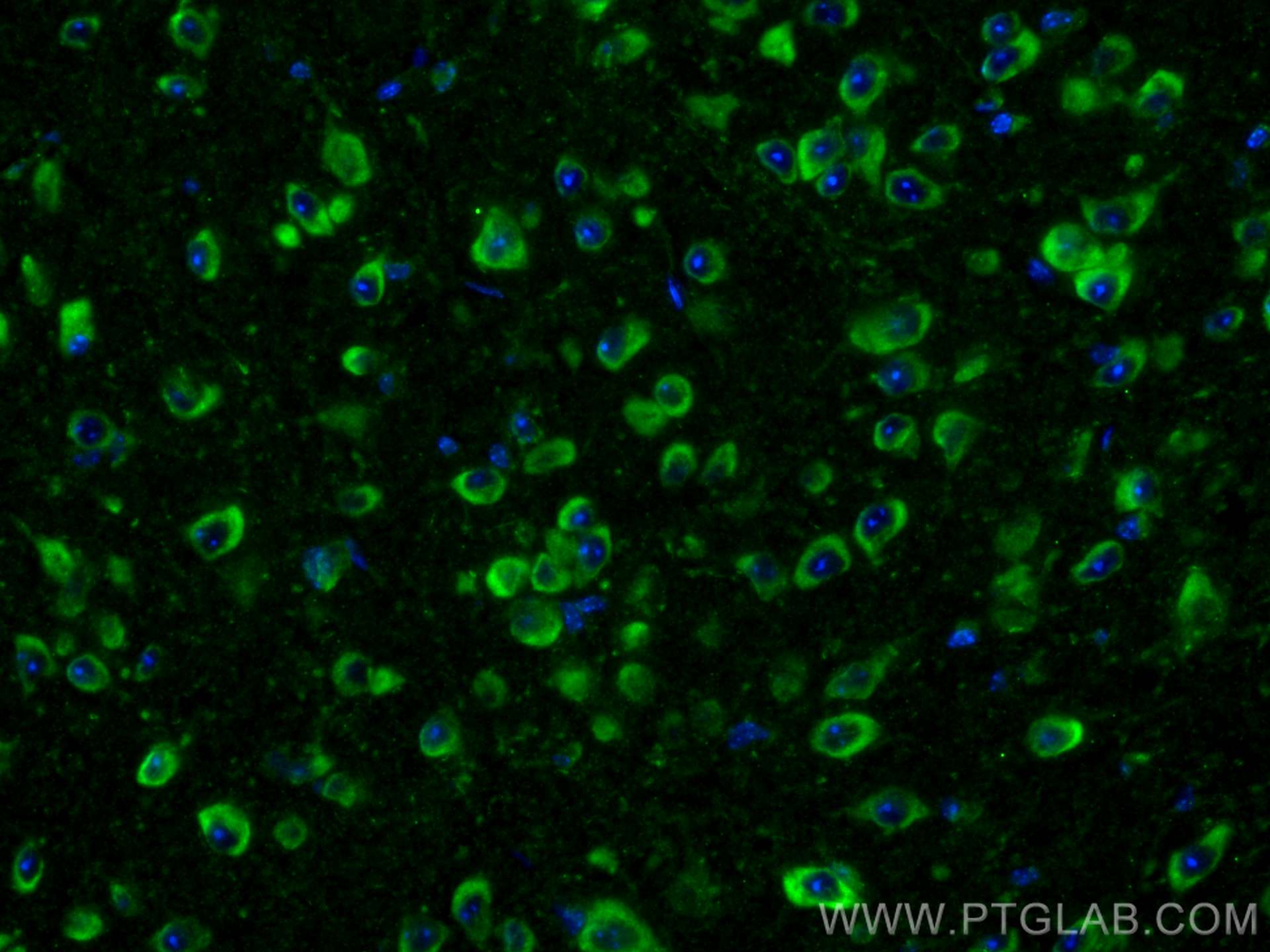 IF Staining of mouse brain using 27761-1-AP