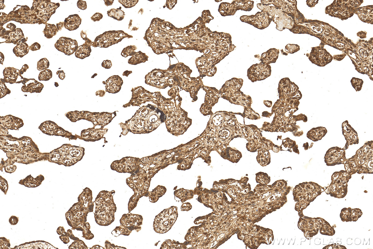 IHC staining of human placenta using 27761-1-AP