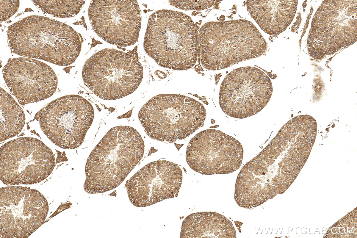 IHC staining of mouse testis using 27761-1-AP