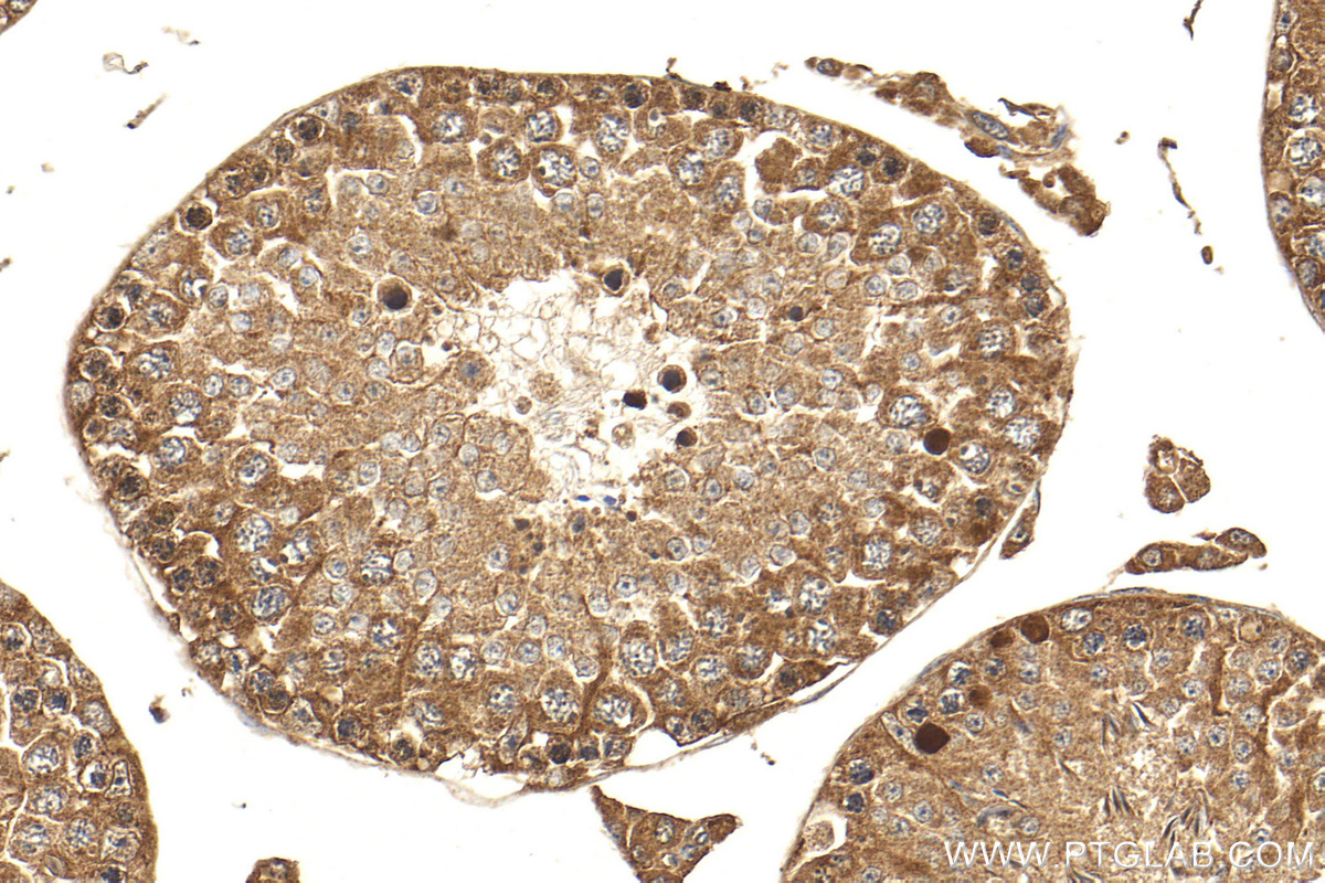 IHC staining of mouse testis using 27761-1-AP