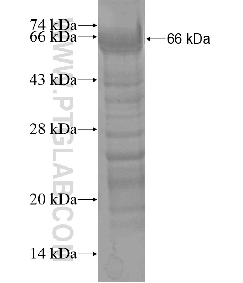 SALL2 fusion protein Ag19427 SDS-PAGE