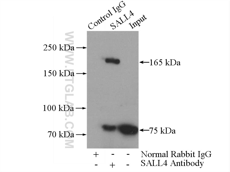 IP experiment of HepG2 using 24500-1-AP