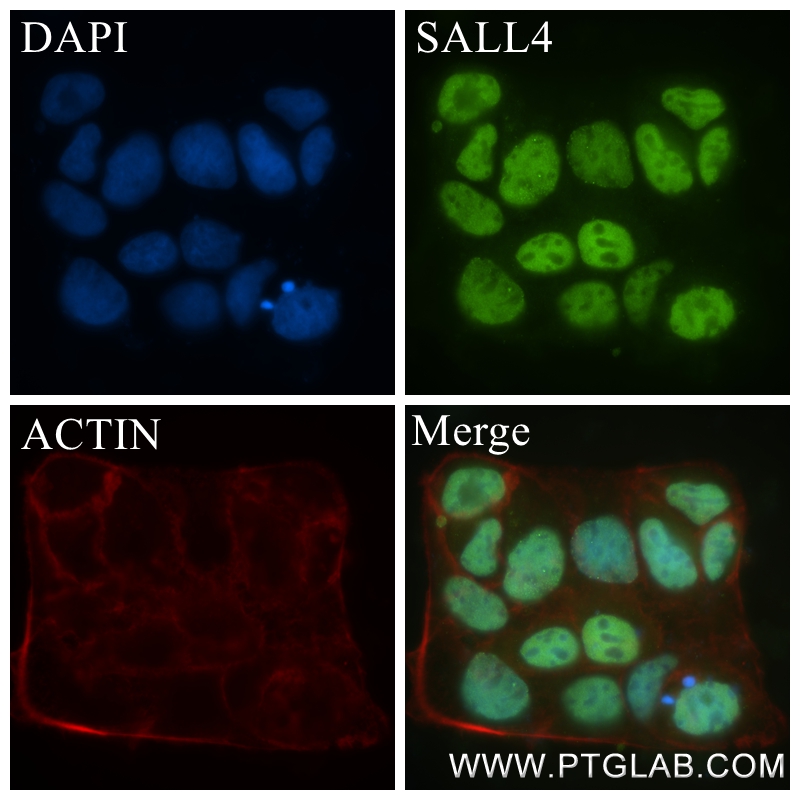 IF Staining of Caco-2 using 83039-4-RR (same clone as 83039-4-PBS)