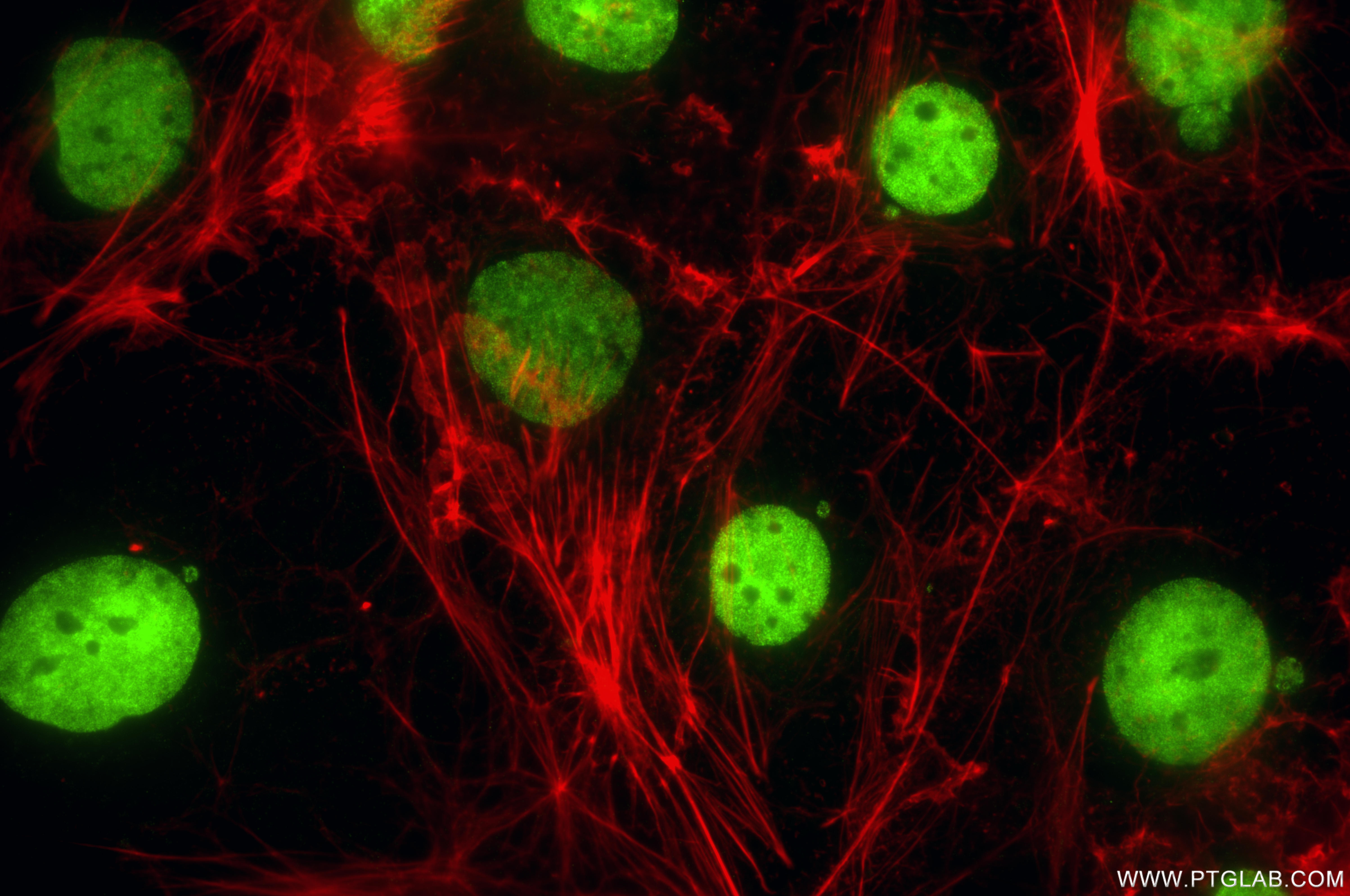 IF Staining of Caco-2 using 83039-7-RR IF Staining of Caco-2 using 83039-7-RR