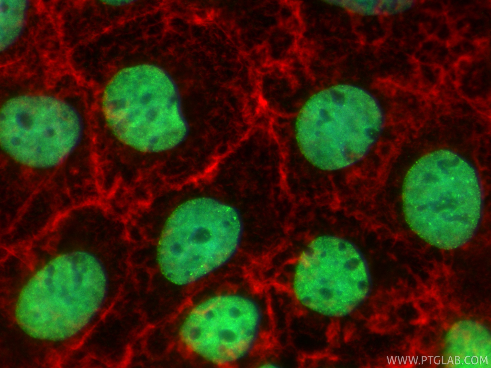 IF Staining of Caco-2 using 83039-8-RR IF Staining of Caco-2 using 83039-8-RR