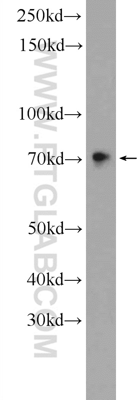 WB analysis of HEK-293 using 24731-1-AP